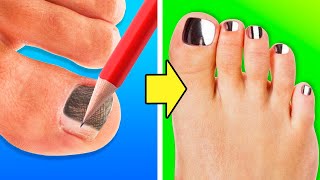 24 AWESOME NAIL HACKS YOU WILL DEFINITELY LIKE