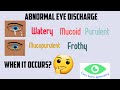 Abnormal eye discharge