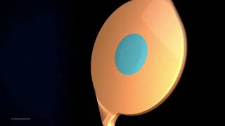 Wavefront-Shaping Presbyopia-Correcting Intraocular Lens - Supplementary Video Id 400083