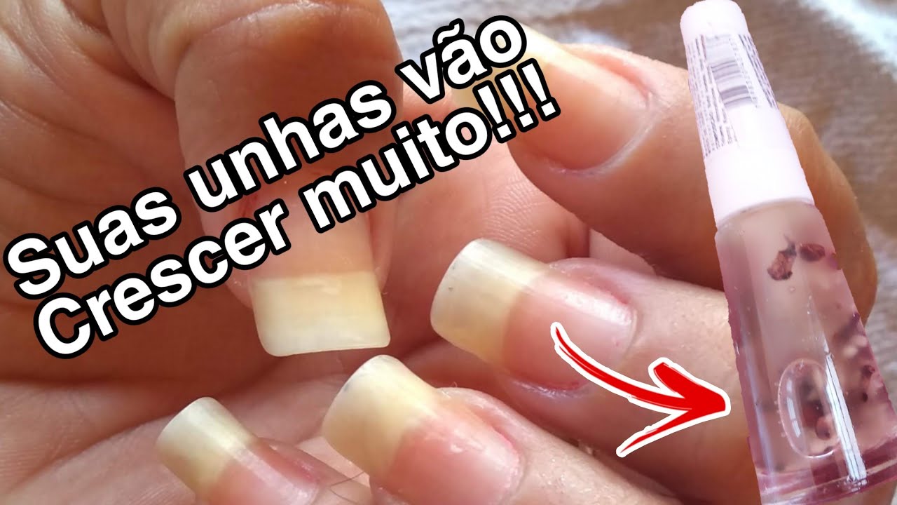 SUAS UNHAS NÃO VÃO MAIS PARAR DE CRESCER COM ESSA RECEITA CASEIRA RÁPIDO, FÁCIL E ECONÔMICO SUAS UNHAS NÃO VÃO MAIS PARAR DE CRESCER COM ESSA RECEITA CASEIRA RÁPIDO, FÁCIL E ECONÔMICO