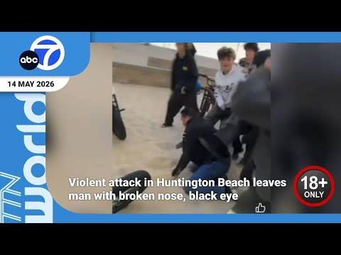 Nose Severed In Violent Attack: Police Investigating