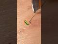 虫っぽい毛根が好き🐛#毛抜き #hairremoval