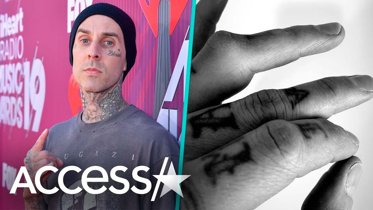 Travis Barker Shares Pic Of Badly Broken Finger Ahead Of Blink-182's World Tour: 'F**k'