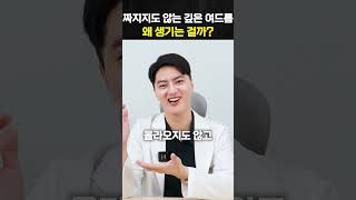 안 짜지는 깊은 여드름.. 왜 생기는 걸까?