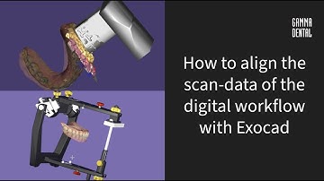 GAMMA Digital Workflow with Exocad