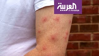 صباح العربية | لماذا ينجذب البعوض لشخص عن غيره؟