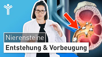 Kann ein Nierenstein unbemerkt abgehen?