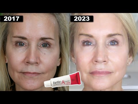 YOUNGER LOOKING SKIN AT 65? | MY 7 YEAR RETIN-A UPDATE!