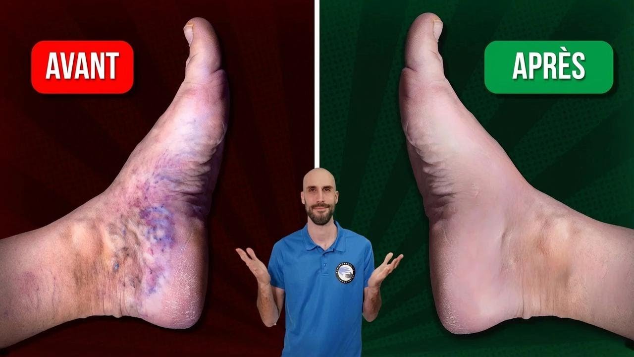 5 exercices efficaces pour booster la circulation dans les jambes