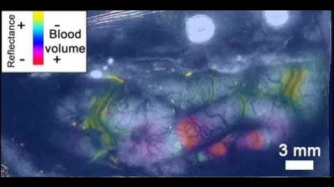 Spreading Depolarization viewed using IOS. Santos et al. Neuroimage 2014