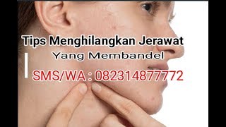 Obat Ampuh Penghilang Komedo Dan Jerawat De Nature