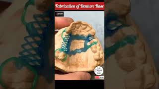 Cast Partial Denture Fabrication | Cast Partial Denture 💯 #shorts #dentist #viral 🔥