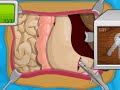 Operate now  stomach surgery  play stomach surgery games