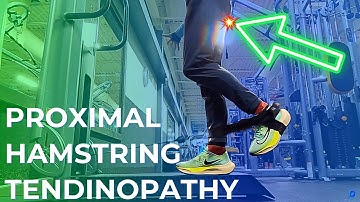 How I BEAT Proximal Hamstring Tendinopathy: Runner
