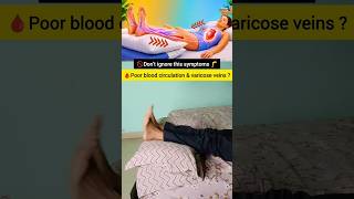 Varicose veins &amp; Poor Circulation Try this Exercise ✅ #varicoseveins #legcirculation #shorts #physio