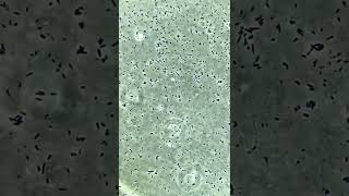 Bacteria versus Caustic Soda under the microscope!