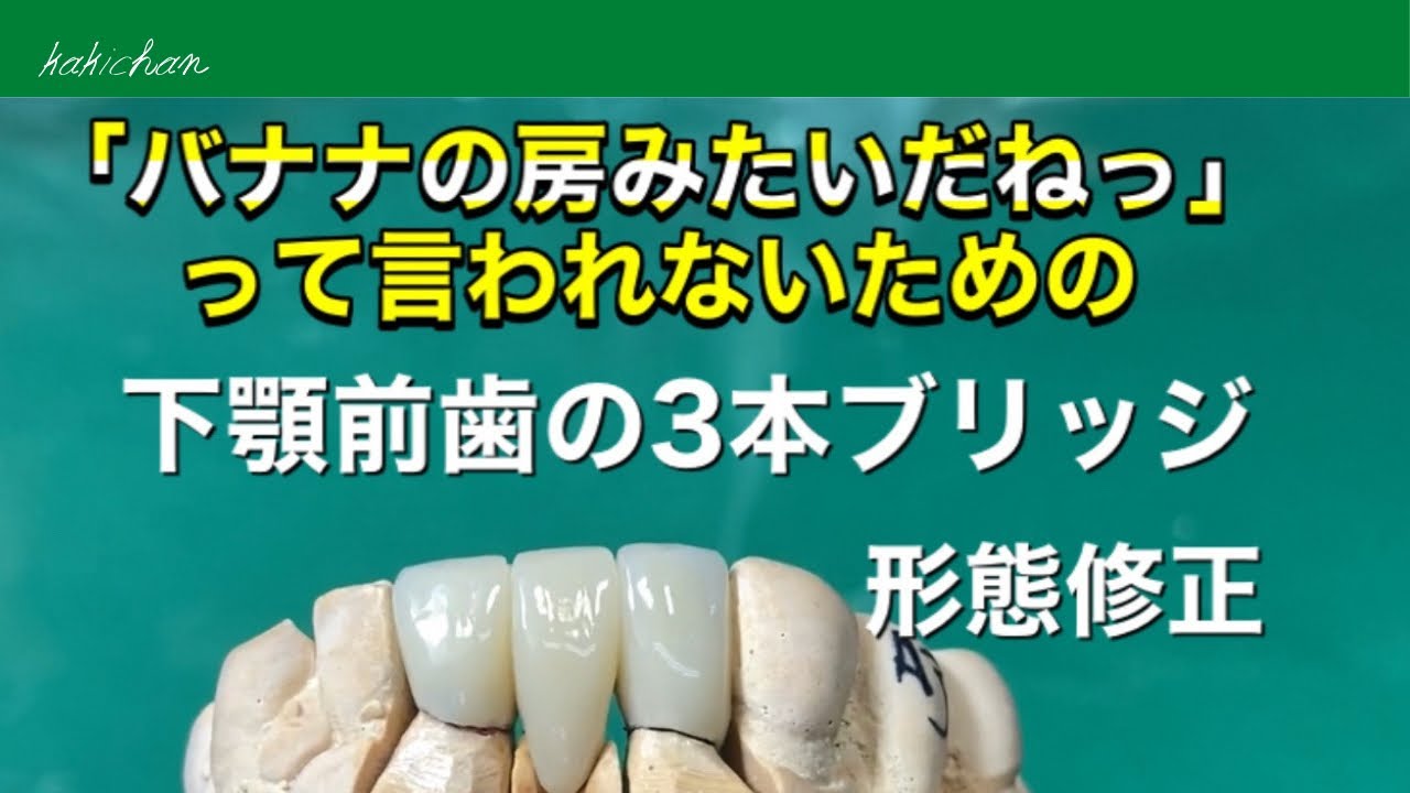 歯科技工 硬質レジン前装冠3本ブリッジの形態修正 Youtube