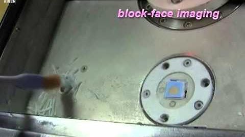 Mapping genes onto brain structures