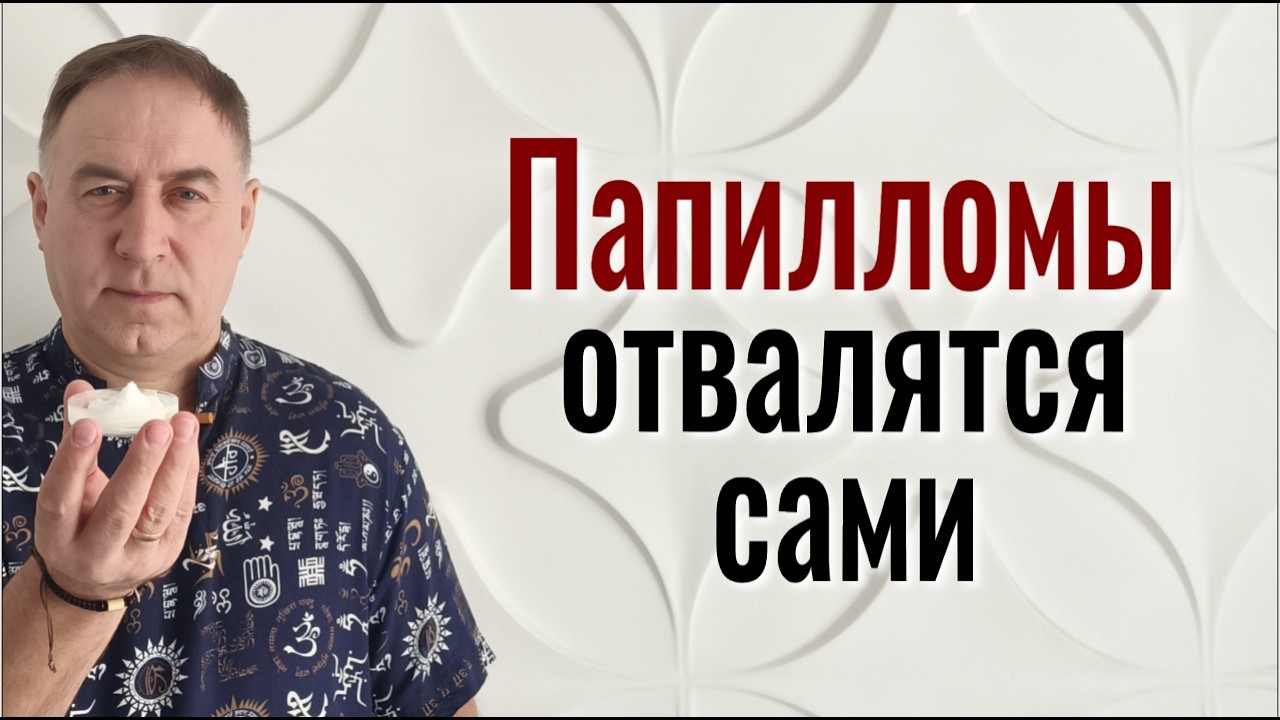 Никакой химии и яда! 5 щепоток Соли и папилломы отвалятся сами Шаманский способ