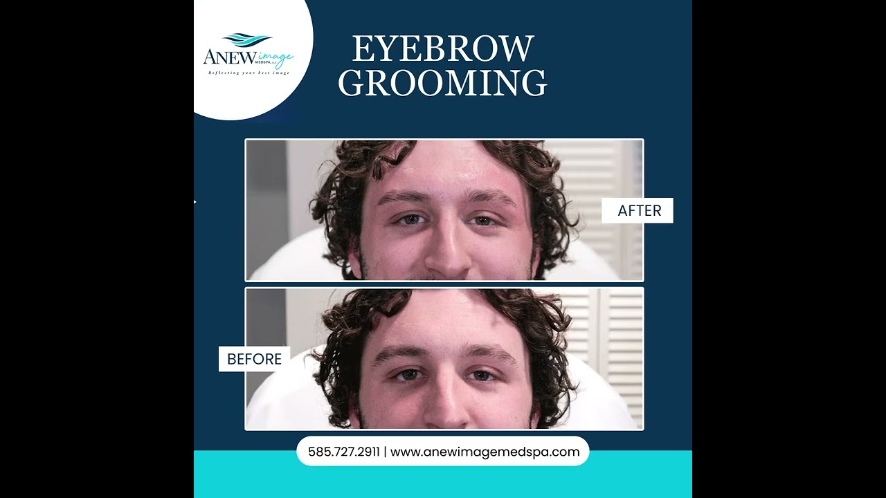Eyebrow Grooming Before and After