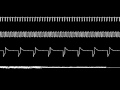 GB - Legend of Zelda Link&#39;s Awakening DX - Tal Tal Heights - Oscilloscope View