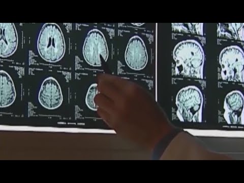 HealthWatch: European Scientists Develop Antibody Treatment And Vaccine To Fight Alzheimer's