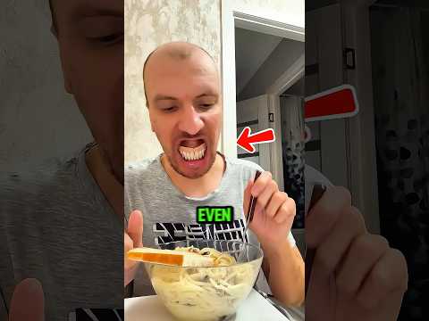 His Teeth Started Moving While Eating Pasta 😬🍝