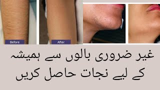 Permanently Remove Unwanted Hair 100% Effective