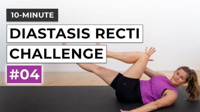 10-Minute Diastasis Recti Challenge (#3)