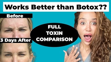 BRAND NEW 2023 Botox Alternative that LASTS Longer! Daxxify - The Longest lasting Toxin