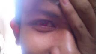 Biokinesis Sharingan