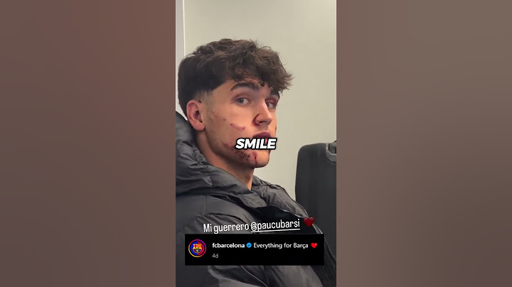PAU CUBARSI WITH 10 STITCHES ON HIS FACE TAKES THE FIELD DESPITE IT 😳 A REAL GLADIATOR 🛡️⚔️