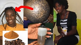 Mix Ginger With Clove To Double Hair Growth / Grow Hair Long And Fast