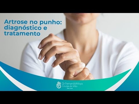 Artrose no punho: diagnóstico e tratamento | Dr. Fernando Moya CRM 112046