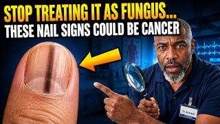 Stop Treating It As Fungus — These Nail Signs Could Be Cancer