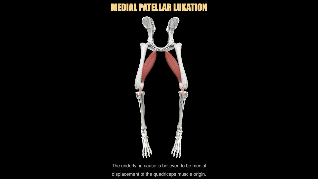 What is patellar luxation?