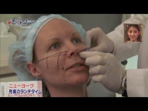 Y LIFT ® Featured On TV Japan NHK-BS1 | Instant, Non Surgical Facelift
