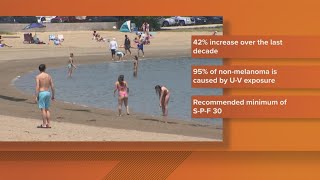Skin cancer rates climb