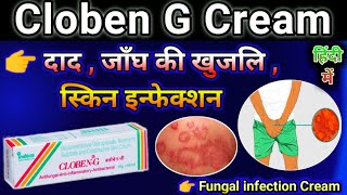 Cloben G Cream Uses In Hindi Cloben Cream Use For Fungal Infection Skin Disease Cream