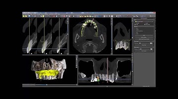 BSP Step by Step Tutorial - Importing a Second Model
