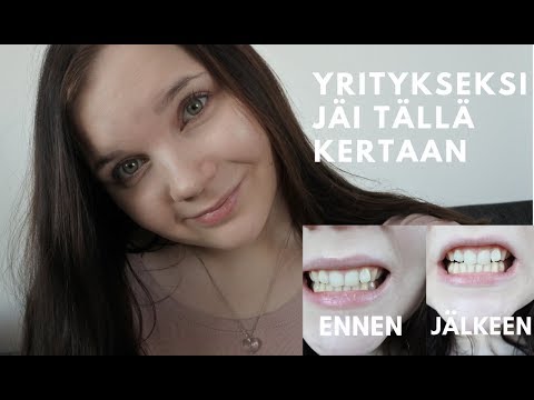 Video: Kuinka Hampaiden Valkaisu Toimii?