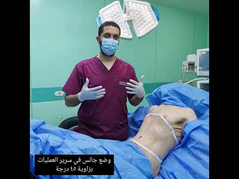 شد ترهلات الجسم بعد عملية تكميم و فقدان وزن كبير جدا