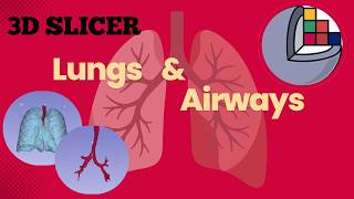🫁 Lungs and Airways segmentation using 3D Slicer