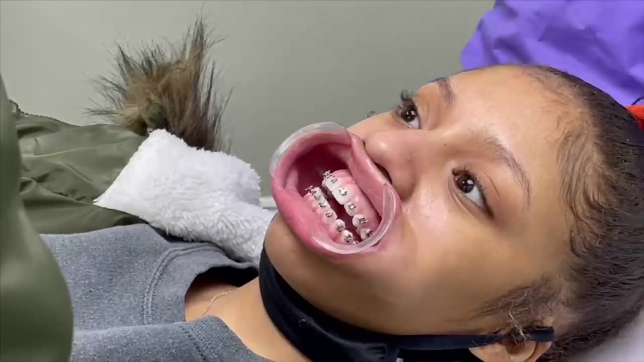 WE GOT BRACES ?! ( VLOG !) |Thewickertwinz