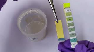 Semen Analysis Test Lab   Complete Video