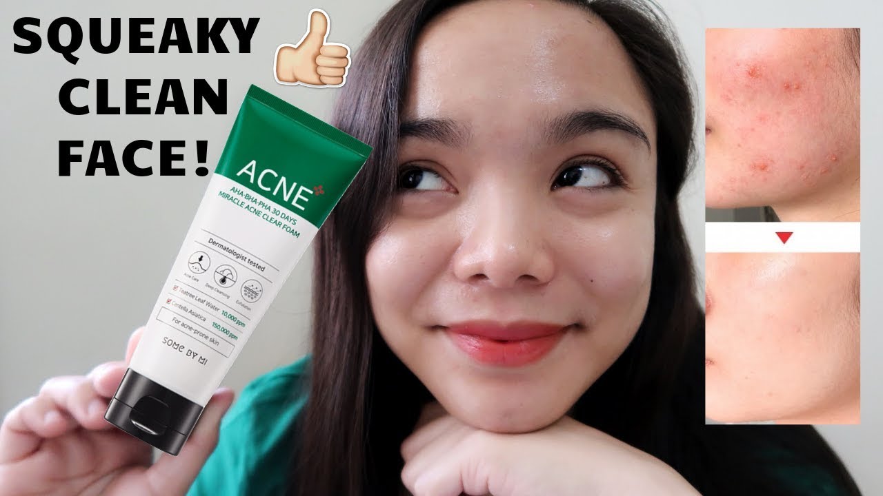 SOME BY MI ACNE SKINCARE REVIEW AHA BHA PHA MIRACLE