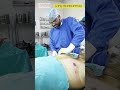 Gynecomastia Surgery | Gynecomastia Liposuction #gym #gynecomastia #shorts #shortsvideo