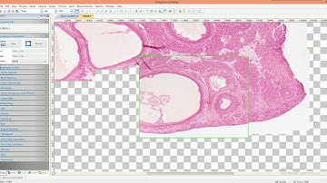 Live Stitching function in ImageFocus Alpha