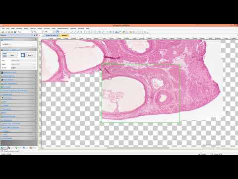 Live Stitching function in ImageFocus Alpha