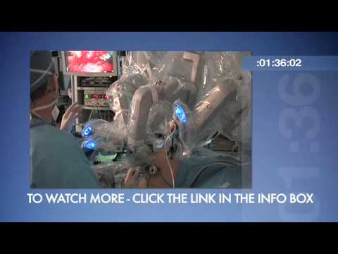 ORLive Express - Robot Assisted Partial Nephrectomy